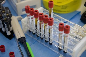 Una serie di provette in un raccoglitore di plastica ed altri oggetti inerenti il prelievo di sangue.