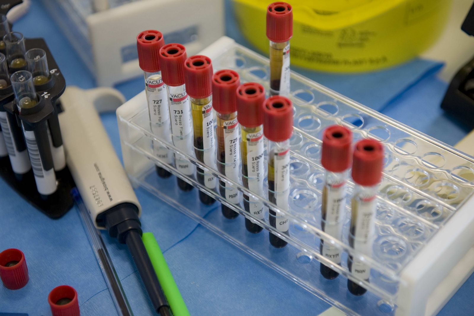 Una serie di provette in un raccoglitore di plastica ed altri oggetti inerenti il prelievo di sangue.